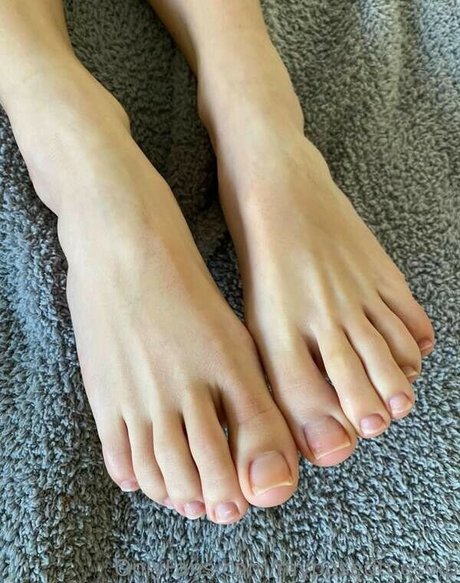 Myposedtoes